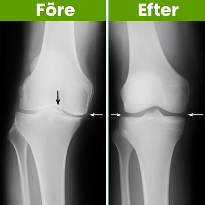 💠 KneeReliefX™ – Stöd med direkt effekt i varje steg.